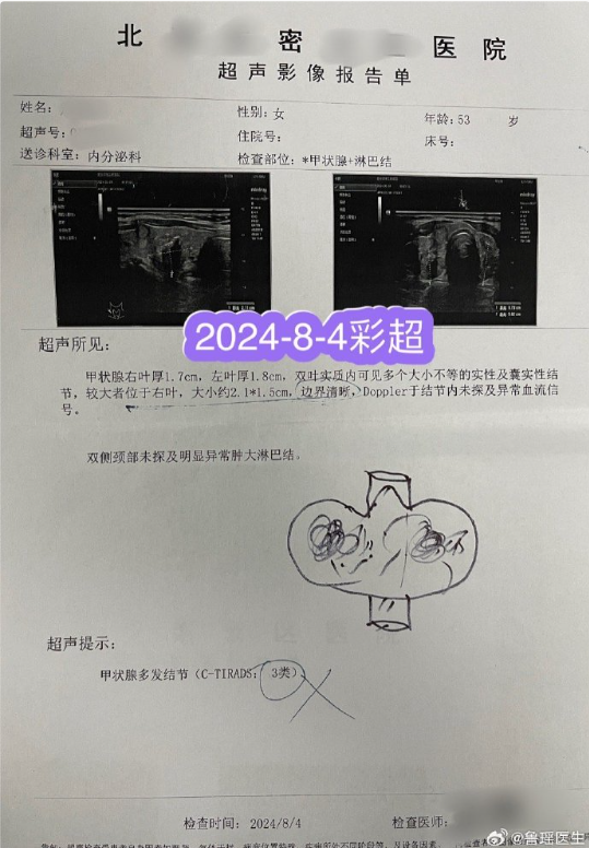 策略吧 无意中将“甲状腺癌结节”观察了7年，最后不仅癌结节长大了，而且还岀现颈部淋巴结转移！